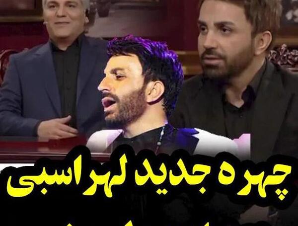 عکس احسان قبل از عمل