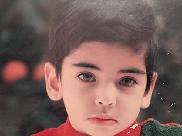 عکس احسان قبل از عمل