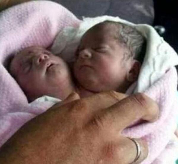 عکس نوزاد مرده