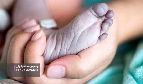 عکس نوزاد مرده
