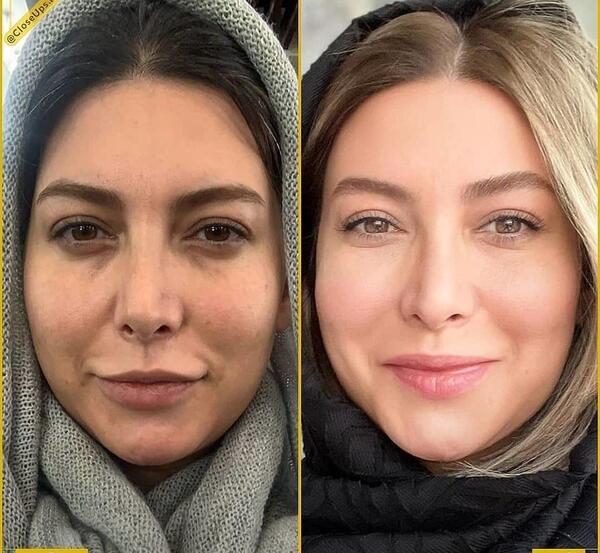 عکس هانیه نادری