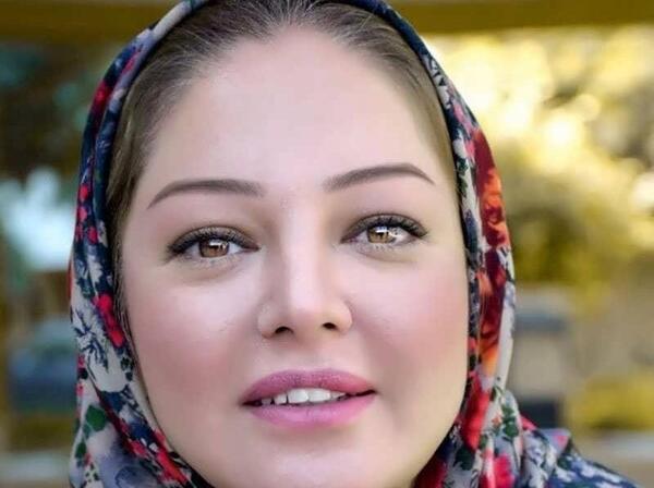 عکس قبل عمل رزیتا غفاری