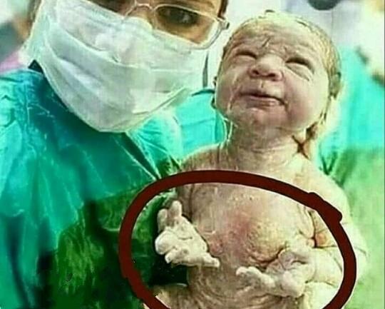 عکس بچه کوچولو تازه به دنیا اومده