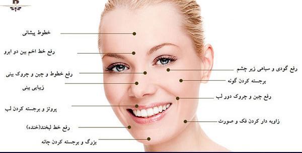 عکس قبل و بعد تزریق ژل بینی