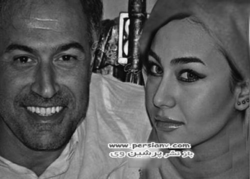 عکس دانیال حکیمی بعد از عمل بینی