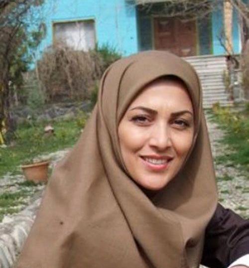 عکس قبل عمل ژیلا صادقی