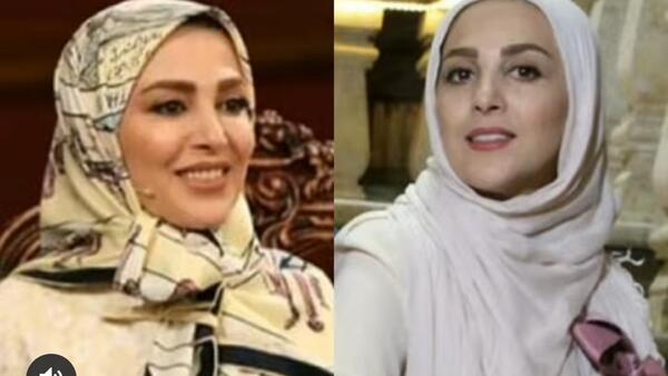 عکس قبل عمل ژیلا صادقی