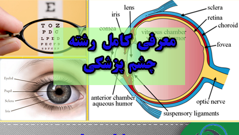 عکس چشم پزشکی
