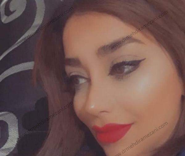 عکس دختر زیبا دماغ عملی