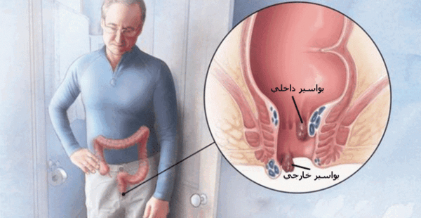 عکس باباسیل