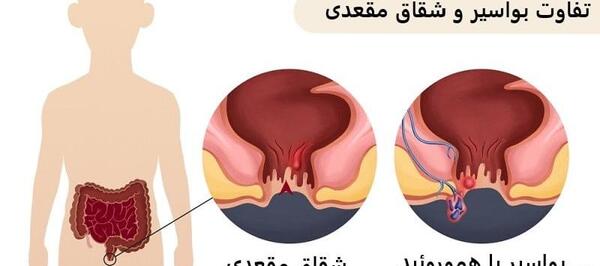 عکس باباسیل