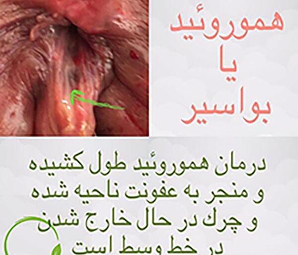عکس باباسیل