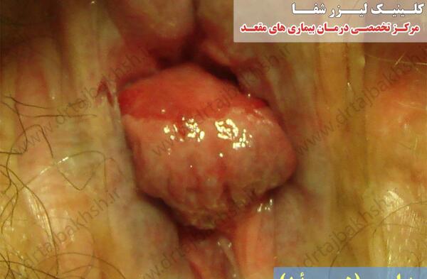 عکس باباسیل