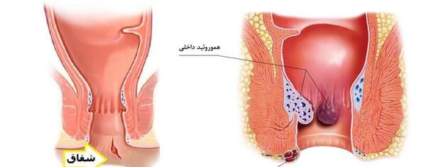 عکس باباسیل