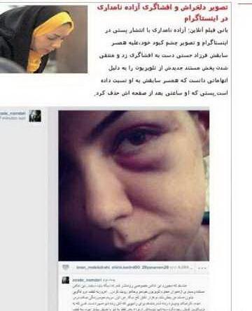 عکس کبود ازاده نامداری