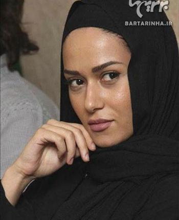 عکس پریناز ایزدیار قبل از عمل