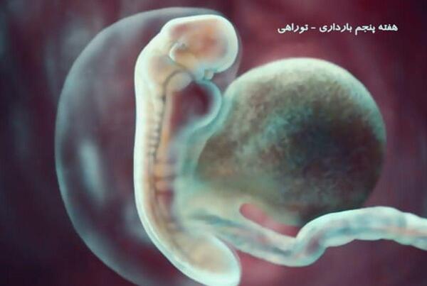 عکس لکه بینی در بارداری نی نی سایت