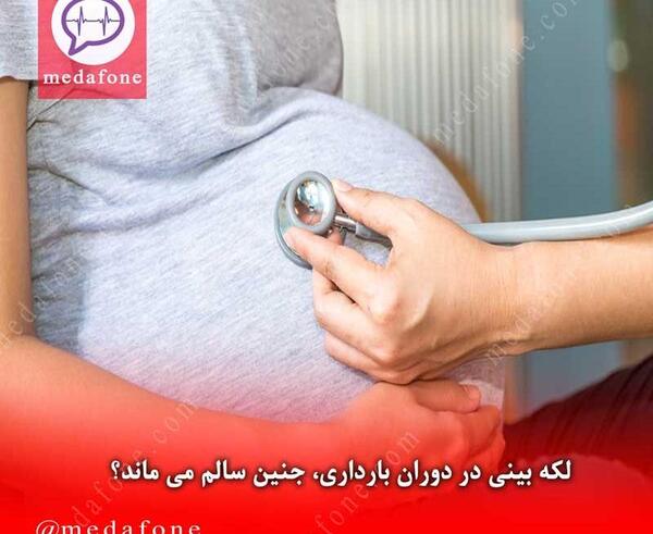 عکس لکه بینی در بارداری نی نی سایت