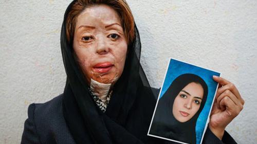عکس مریم قربانی اسید پاشی