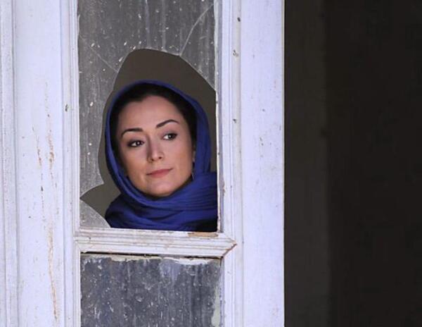 عکس مریم قربانی اسید پاشی
