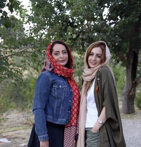 عکس شقایق دهقان بعد از عمل بینی