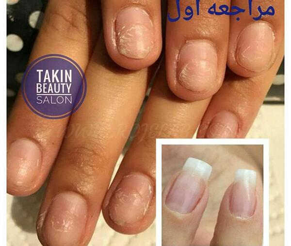عکس طنز کاشت ناخن