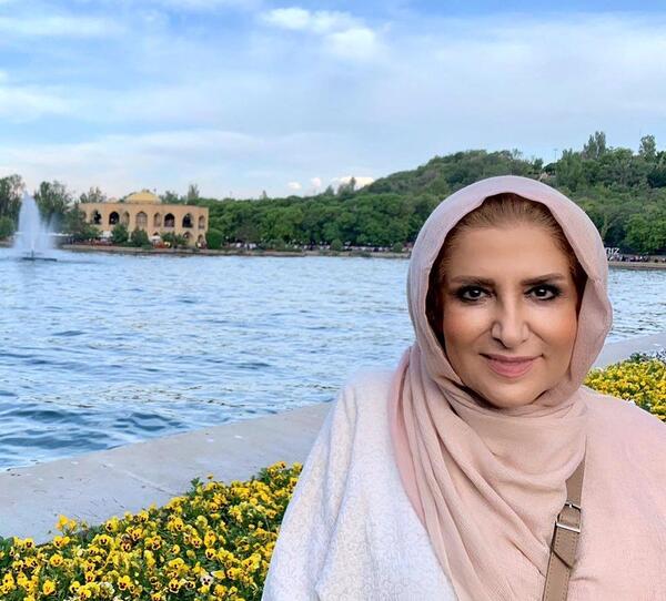 عکس قبل از عمل ژیلا صادقی