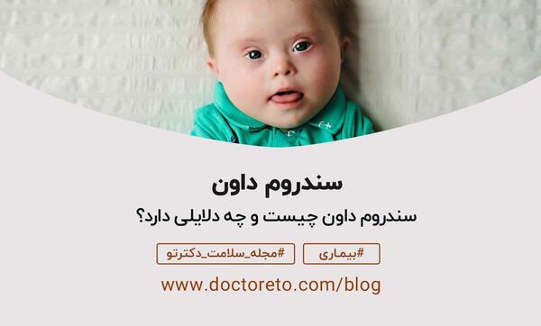عکس نوزاد سندروم داون