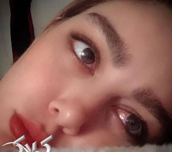 عکس چشمان گریان طبیعی
