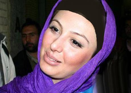 عکس ضیغمی قبل از عمل