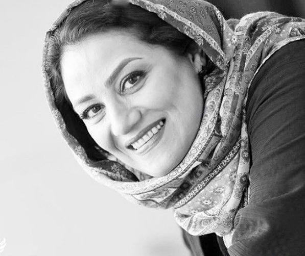 عکس لبخند مصنوعی