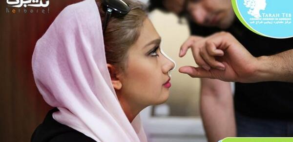 عکس سه بعدی عمل بینی