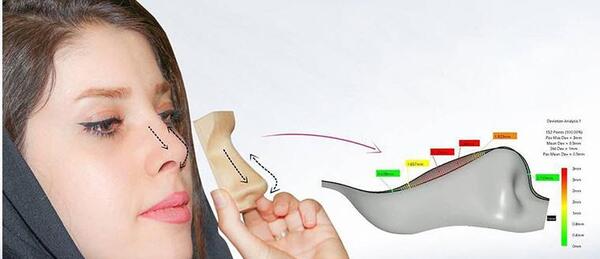 عکس سه بعدی عمل بینی