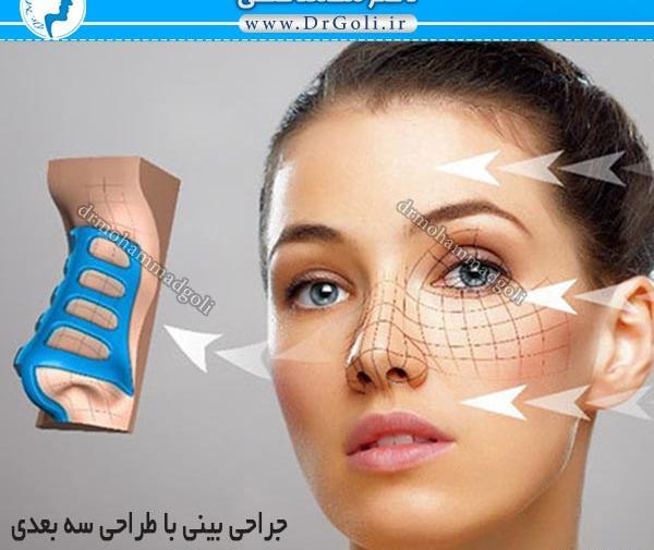 عکس سه بعدی عمل بینی