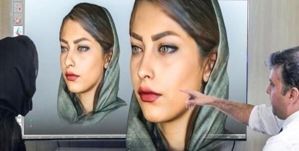 عکس سه بعدی عمل بینی