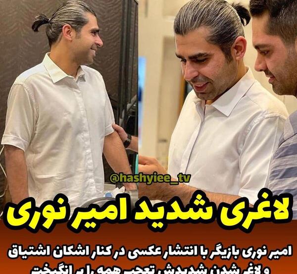 عکس امیر نوری بعد لاغری
