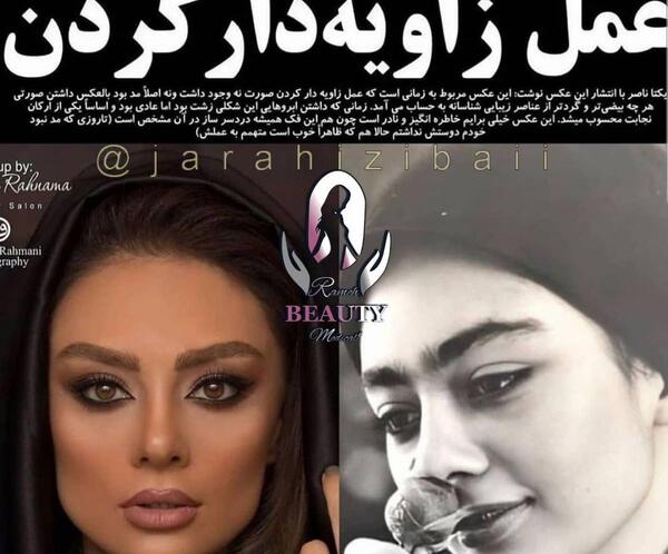 عکس قبل از عمل یکتا ناصر