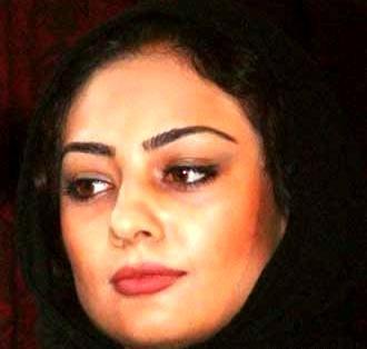 عکس قبل از عمل یکتا ناصر