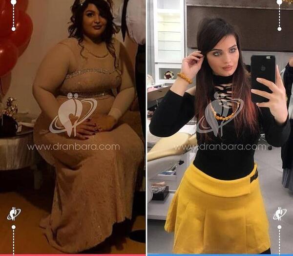عکس لاغری قبل و بعد