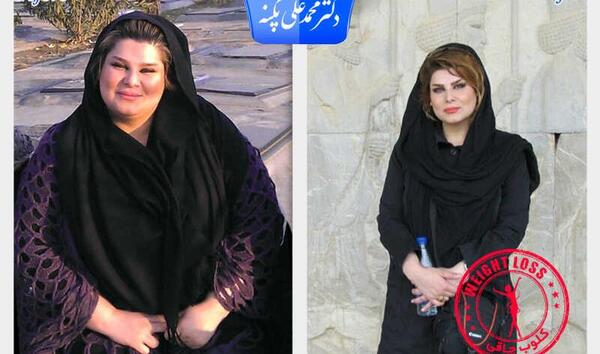 عکس لاغری قبل و بعد