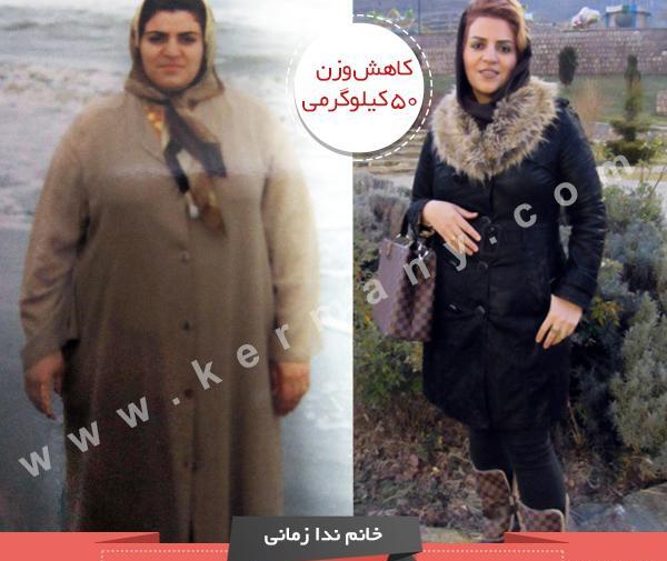 عکس های قبل و بعد از رژیم لاغری ایرانی