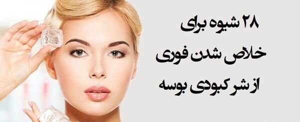 عکس کبودی جای بوسه
