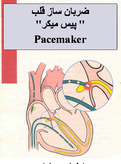 عکس دستگاه ضربان ساز قلب