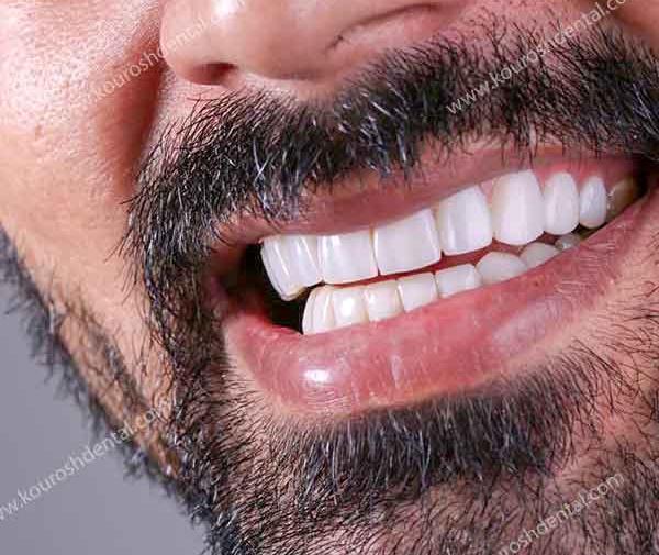 عکس لبخند مردانه