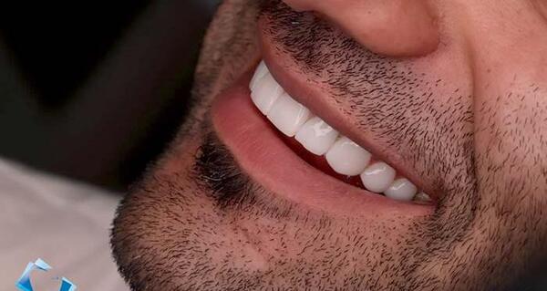 عکس لبخند مردانه