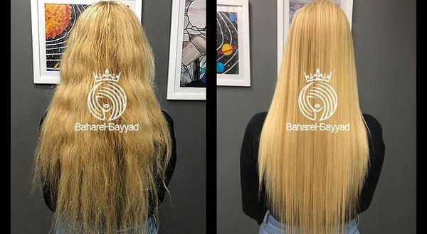 عکس کراتینه قبل و بعد