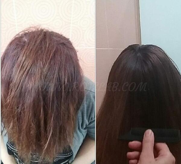 عکس کراتینه قبل و بعد