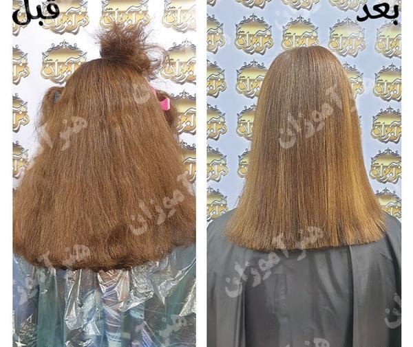 عکس کراتینه قبل و بعد