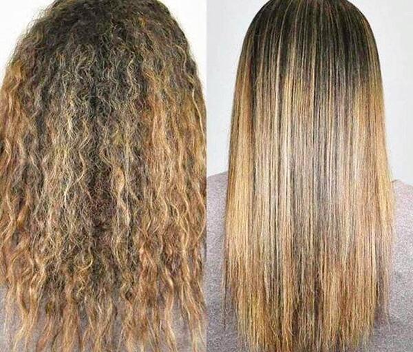 عکس کراتینه قبل و بعد