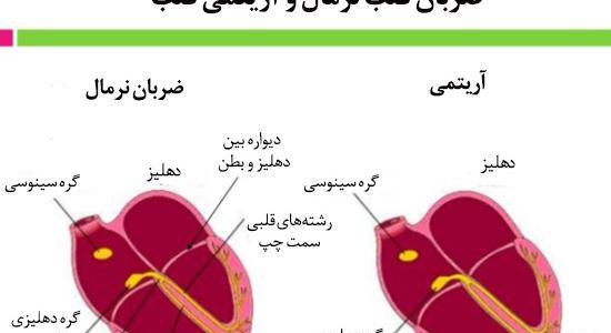 عکس تصاویر ضربان قلب نامنظم